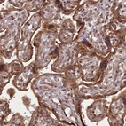 Immunohistochemical staining of human placenta shows moderate cytoplasmic positivity in trophoblastic cells.