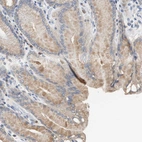 Immunohistochemical staining of human stomach shows moderate cytoplasmic positivity in glandular cells.