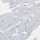 Immunohistochemical staining of human skeletal muscle shows no cytoplasmic positivity in myocytes as expected.