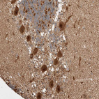 Immunohistochemical staining of human cerebellum shows strong nuclear positivity in Purkinje cells.