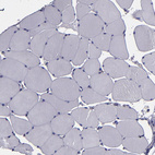 Immunohistochemical staining of human skeletal muscle shows no cytoplasmic positivity in myocytes as expected.
