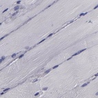 Immunohistochemical staining of human skeletal muscle using Anti-CARS antibody HPA002383.