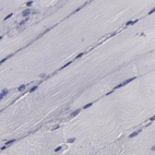 Immunohistochemical staining of human skeletal muscle using Anti-CARS antibody HPA002383.