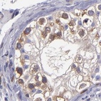 Immunohistochemical staining of human testis using Anti-CARS antibody HPA002383.