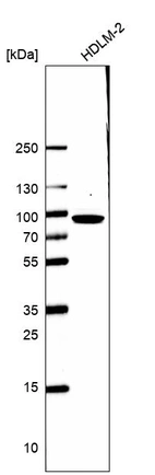 Western blot analysis in human cell line HDLM-2.
