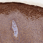 Immunohistochemical staining of human skin shows strong cytoplasmic positivity in squamous epithelial cells.