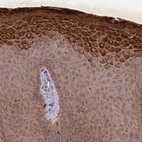 Immunohistochemical staining of human skin shows strong cytoplasmic positivity in squamous epithelial cells.