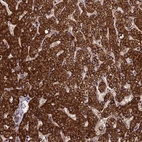 Immunohistochemical staining of human liver shows strong cytoplasmic positivity in hepatocytes.