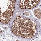 Immunohistochemical staining of human testis shows moderate cytoplasmic positivity in cells in seminiferous ducts.