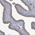 Immunohistochemical staining of human fallopian tube shows strong cytoplasmic positivity in ciliated cells.