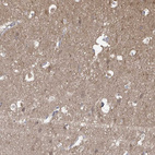 Immunohistochemical staining of human cerebral cortex shows moderate cytoplasmic positivity in neuropil.