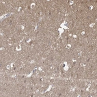 Immunohistochemical staining of human cerebral cortex shows moderate cytoplasmic positivity in neuropil.