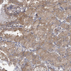 Immunohistochemical staining of human stomach shows moderate cytoplasmic positivity in glandular cells.