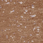 Immunohistochemical staining of human cerebral cortex shows strong cytoplasmic positivity in neuropil.
