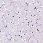 Immunohistochemical staining of human skeletal muscle shows no positivity in myocytes.