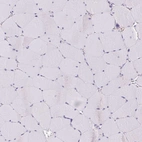 Immunohistochemical staining of human skeletal muscle shows no positivity in myocytes.