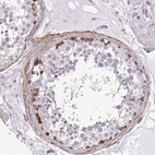 Immunohistochemical staining of human testis shows moderate cytoplasmic positivity in cells in seminiferous ducts.