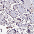 Immunohistochemical staining of human placenta shows weak cytoplasmic positivity in trophoblastic cells.