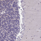 Immunohistochemical staining of human cerebellum shows no positivity in Purkinje cells.