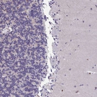 Immunohistochemical staining of human cerebellum shows no positivity in Purkinje cells.