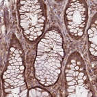 Immunohistochemical staining of human rectum shows strong cytoplasmic positivity in glandular cells.