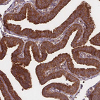 Immunohistochemical staining of human fallopian tube shows strong cytoplasmic positivity in glandular cells.