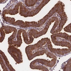 Immunohistochemical staining of human fallopian tube shows strong cytoplasmic positivity in glandular cells.