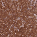 Immunohistochemical staining of human pancreas shows strong cytoplasmic positivity in exocrine glandular cells.