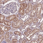 Immunohistochemical staining of human kidney shows moderate cytoplasmic granular positivity in cells in tubules.