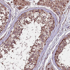 Immunohistochemical staining of human testis shows moderate cytoplasmic granular positivity in cells in seminiferous ducts.