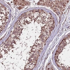 Immunohistochemical staining of human testis shows moderate cytoplasmic granular positivity in cells in seminiferous ducts.