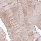 Immunohistochemical staining of human skeletal muscle shows weak cytoplasmic positivity in myocytes.
