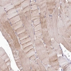 Immunohistochemical staining of human skeletal muscle shows weak cytoplasmic positivity in myocytes.