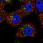 Immunofluorescent staining of human cell line U-251 MG shows positivity in vesicles.