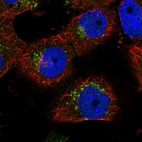 Immunofluorescent staining of human cell line U-251 MG shows positivity in vesicles.