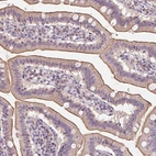 Immunohistochemical staining of human duodenum shows moderate membranous positivity in glandular cells.
