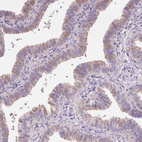 Immunohistochemical staining of human fallopian tube shows moderate membranous positivity in glandular cells.