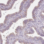 Immunohistochemical staining of human fallopian tube shows moderate membranous positivity in glandular cells.