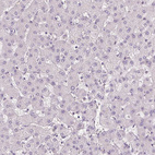 Immunohistochemical staining of human liver shows no positivity in hepatocytes, as expected.