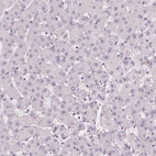 Immunohistochemical staining of human liver shows no positivity in hepatocytes, as expected.