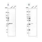 Western blot analysis using Anti-MS4A1 antibody HPA014341 (A) shows similar pattern to independent antibody HPA014391 (B).