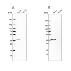 Western blot analysis using Anti-MS4A1 antibody HPA014391 (A) shows similar pattern to independent antibody HPA014341 (B).