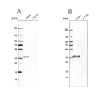 Western blot analysis using Anti-MS4A1 antibody HPA014391 (A) shows similar pattern to independent antibody HPA014341 (B).