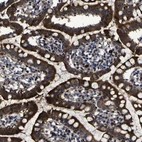 Immunohistochemical staining of human small intestine shows strong cytoplasmic positivity in glandular cells.