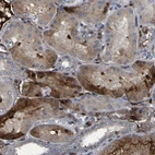Immunohistochemical staining of human kidney shows moderate cytoplasmic positivity in cells in tubules.