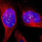Immunofluorescent staining of human cell line U-2 OS shows localization to nucleoli fibrillar center.
