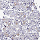 Immunohistochemical staining of human salivary gland shows moderate cytoplasmic positivity in glandular cells.