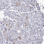 Immunohistochemical staining of human salivary gland shows moderate cytoplasmic positivity in glandular cells.