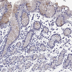 Immunohistochemical staining of human stomach shows moderate cytoplasmic positivity in glandular cells.