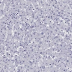 Immunohistochemical staining of human liver shows negative positivity in hepatocytes.